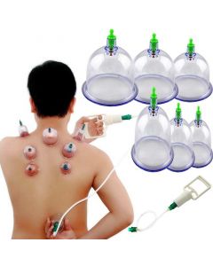 Buy Massage cups for joints 'PULL OUT A VACUUM APPARATUS', 6pcs  | Florida Online Pharmacy | https://florida.buy-pharm.com